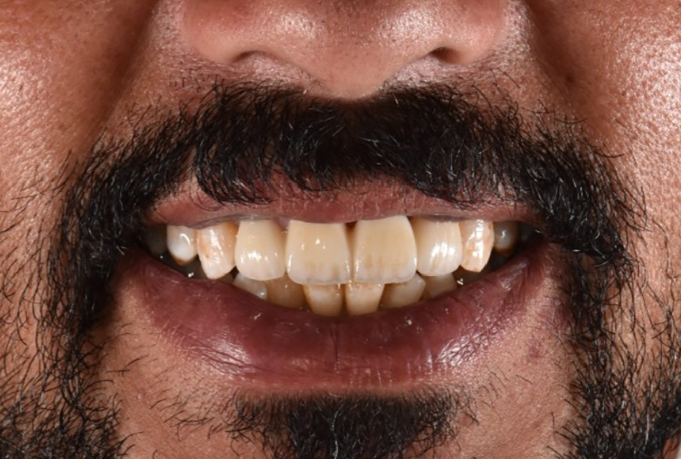 Dentality Oral Care Clinic